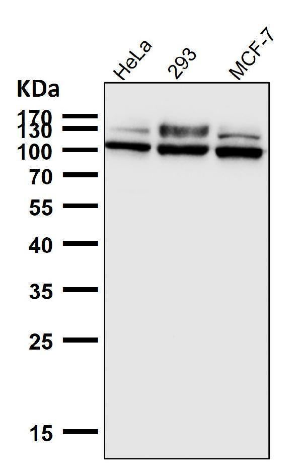 All lanes use the Antibody at 1:5K dilution for 1 hour at room temperature.