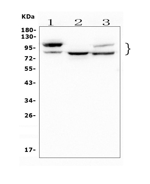 Anti-GAA Antibody Picoband® (monoclonal, 2G7)