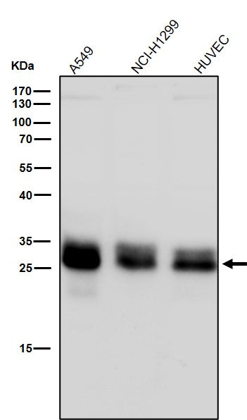 All lanes use the Antibody at 1:2000 dilution for 1 hour at room temperature.