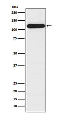 Western blot analysis of BubR1 expression in HepG2 cell lysate.