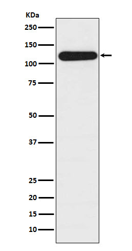 Western blot analysis of BubR1 expression in HepG2 cell lysate.
