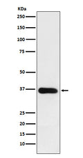 Western blot analysis of HSD11B1 expression in human fetal liver lysate.