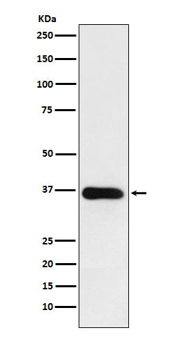 Western blot analysis of HSD11B1 expression in human fetal liver lysate.