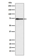 Western blot analysis of PROS1 expression in Human plasma lysate.