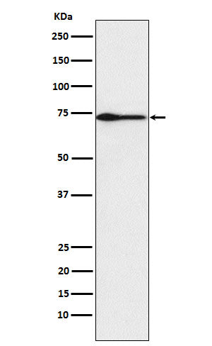 Western blot analysis of PROS1 expression in Human plasma lysate.