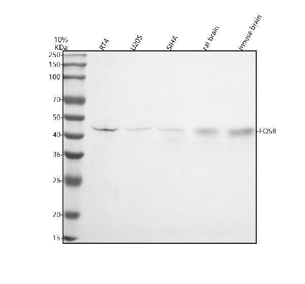 Anti-Fos B Rabbit Monoclonal Antibody