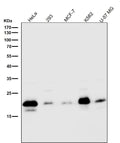 All lanes use the Antibody at 1:1W dilution for 1 hour at room temperature.