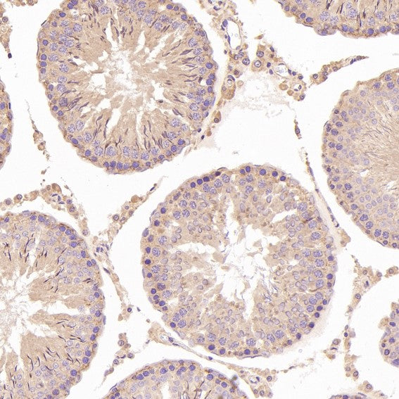 Anti-N-Cadherin-2 CDH2 CD325-Rabbit Monoclonal Antibody
