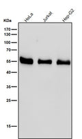 All lanes use the Antibody at 1:1K dilution for 1 hour at room temperature.