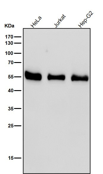 All lanes use the Antibody at 1:1K dilution for 1 hour at room temperature.