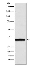 Anti-GDF15 Rabbit Monoclonal Antibody