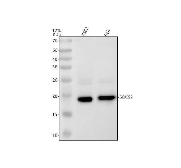 Anti-SOCS2 Rabbit Monoclonal Antibody