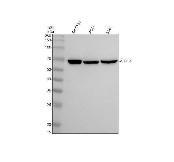 Anti-Parathyroid Hormone Receptor 1 Monoclonal Antibody