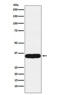 Western blot analysis of Tropomyosin 1 expression in Human heart lysate.
