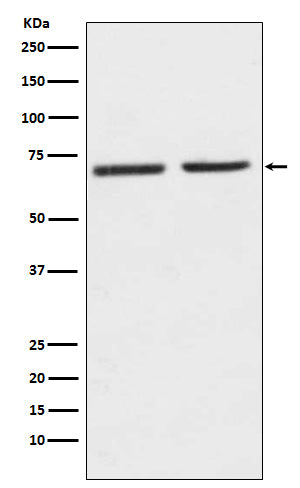 Western blot analysis of 5HT2C Receptor expression in (1) SH-SY5Y cell lysate; (2) Mouse kidney lysate.