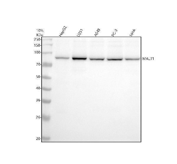 Anti-MALT1 Monoclonal Antibody