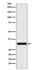 Western blot analysis of RAB27A expression in MCF-7 cell lysate.