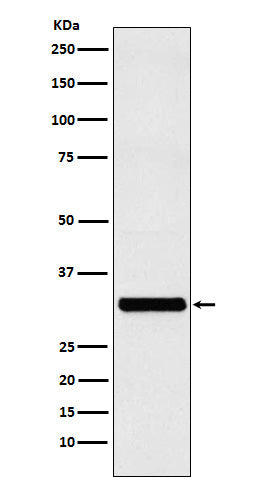 Western blot analysis of RAB27A expression in MCF-7 cell lysate.