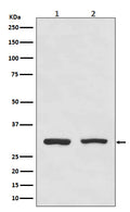 Western blot analysis of Bcl10 expression in (1) HeLa cell lysate; (2) Raji cell lysate.