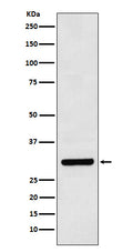 Western blot analysis of Bcl10 expression in Daudi cell lysate.