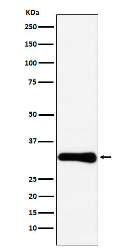 Western blot analysis of Bcl10 expression in HeLa cell lysate.