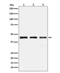 Western blot analysis of PGD expression in (1) 293 cell lysate; (2) Mouse kidney lysate; (3) Rat kidney lysate.