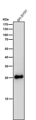 All lanes use the Antibody at 1:3K dilution for 1 hour at room temperature.