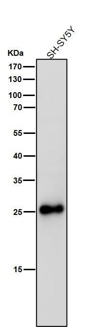 All lanes use the Antibody at 1:3K dilution for 1 hour at room temperature.