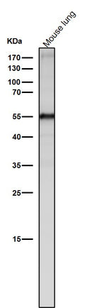 All lanes use the Antibody at 1:2K dilution for 1 hour at room temperature.
