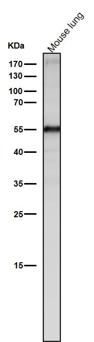 All lanes use the Antibody at 1:2K dilution for 1 hour at room temperature.