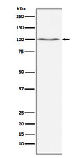 Western blot analysis of Dynamin 2 expression in Jurkat cell lysate.