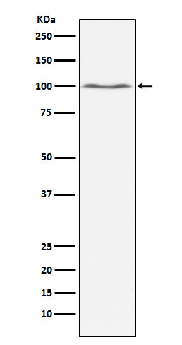 Western blot analysis of Dynamin 2 expression in Jurkat cell lysate.