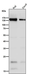 All lanes use the Antibody at 1:3K dilution for 1 hour at room temperature.