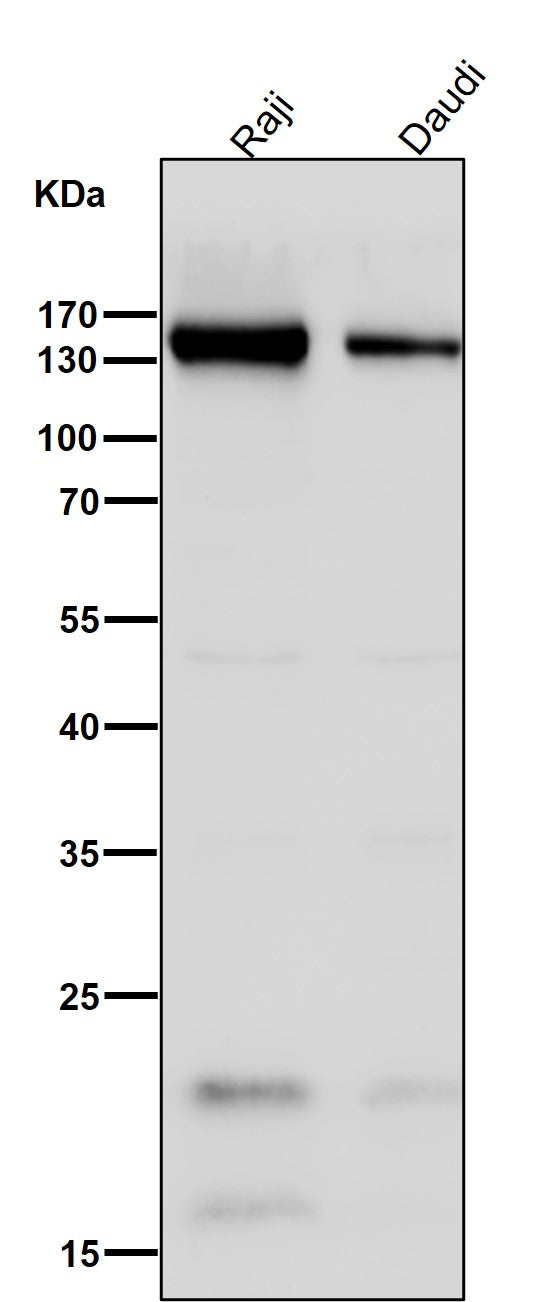 All lanes use the Antibody at 1:3K dilution for 1 hour at room temperature.