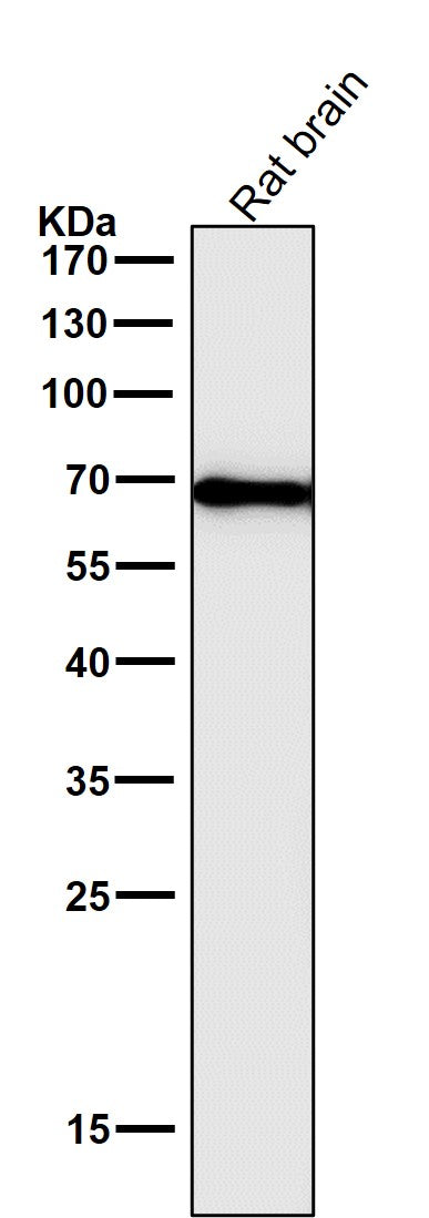 All lanes use the Antibody at 1:2W dilution for 1 hour at room temperature.