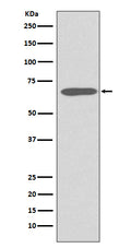 Western blot analysis of Cytokeratin 1 expression in Human skin lysate.