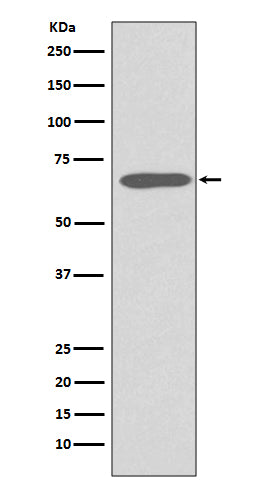 Western blot analysis of Cytokeratin 1 expression in Human skin lysate.