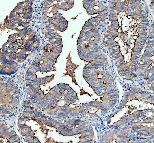 Anti-CA125 / MUC16 Monoclonal Antibody