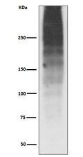 Western blot analysis of MUC16 expression in Human ovary cancer lysate.