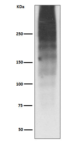 Western blot analysis of MUC16 expression in Human ovary cancer lysate.