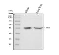 Anti-TPH2 Rabbit Monoclonal Antibody