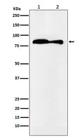 Western blot analysis of VPS35 expression in (1) HeLa cell lysate; (2) Mouse kidney lysate.