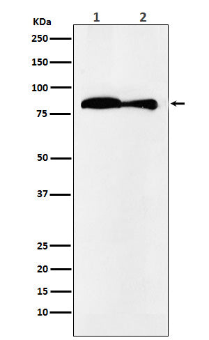 Western blot analysis of VPS35 expression in (1) HeLa cell lysate; (2) Mouse kidney lysate.