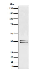 Western blot analysis of LAT expression in Jurkat cell lysate.