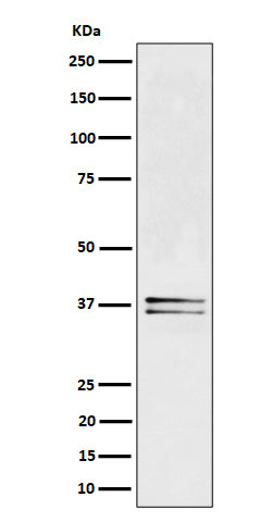 Western blot analysis of LAT expression in Jurkat cell lysate.