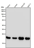 All lanes use the Antibody at 1:5K dilution for 1 hour at room temperature.