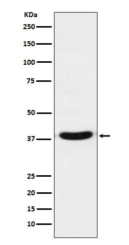 Western blot analysis of TRBP expression in Jurkat cell lysate.