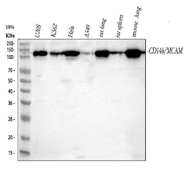 Anti-CD146 MCAM Rabbit Monoclonal Antibody