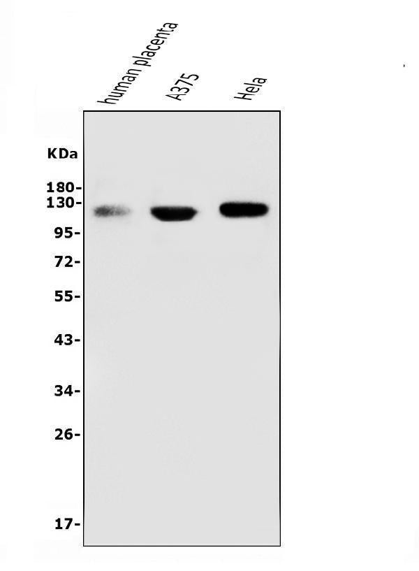 Anti-CD146/MCAM Antibody Picoband® (monoclonal, 2H12)