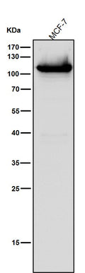 All lanes use the Antibody at 1:1k dilution for 1 hour at room temperature.